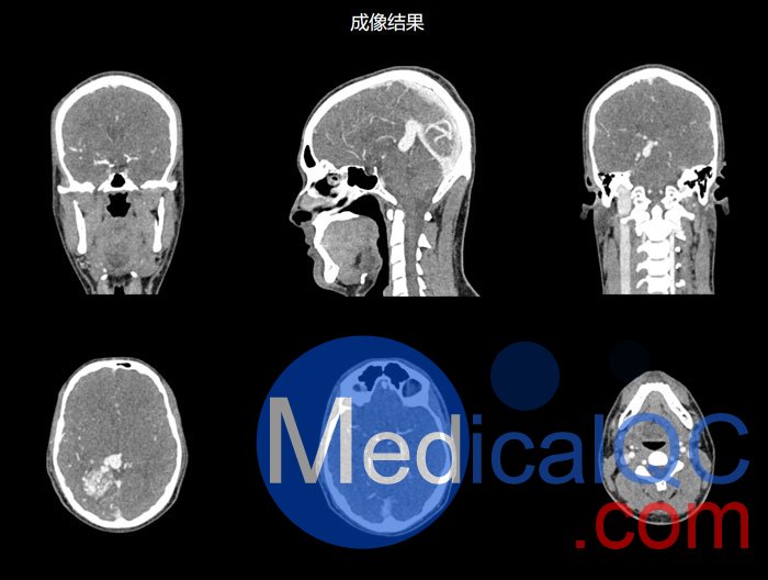 NLP1000頭頸模體，NLP1000頭部模體，NLP1000頭模