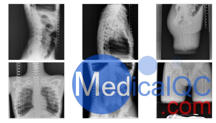CT-A01成人軀干模體,CT-A01成人軀干模型X射線成像效果