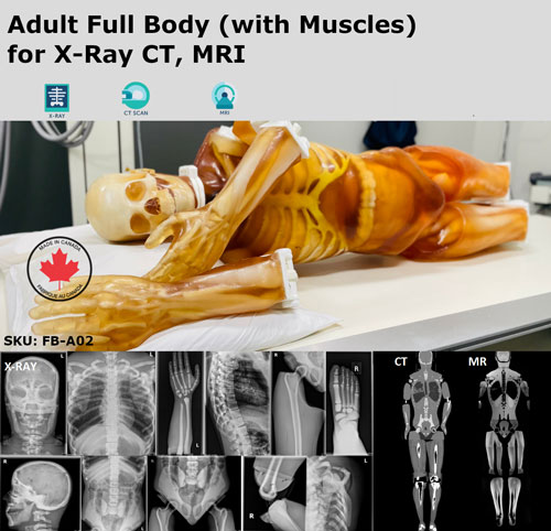 FB-A02成人全身模體,FB-A02全身CT模型，適用于X射線，CT,MRI